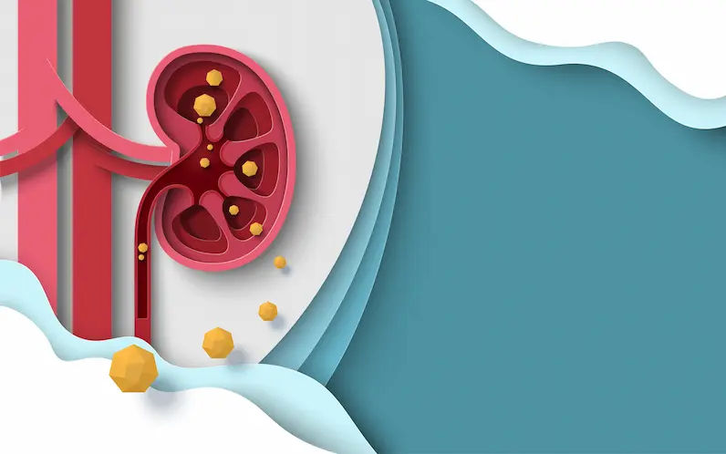 ESWL Treatment A Non-Surgical Guide to Breaking Kidney Stones